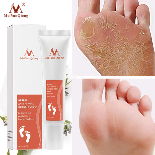 Foot Care Cream Foot spa Pedicure Herbal Detox Anti Fungal Infection Onychomycosis Fungus Treatment For legs