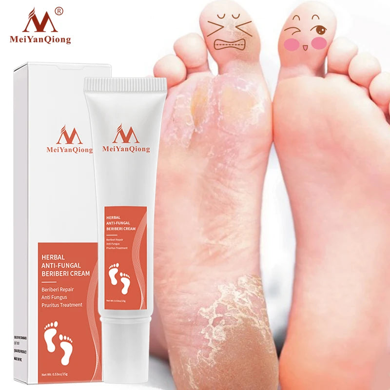 Foot Care Cream Foot spa Pedicure Herbal Detox Anti Fungal Infection Onychomycosis Fungus Treatment For legs