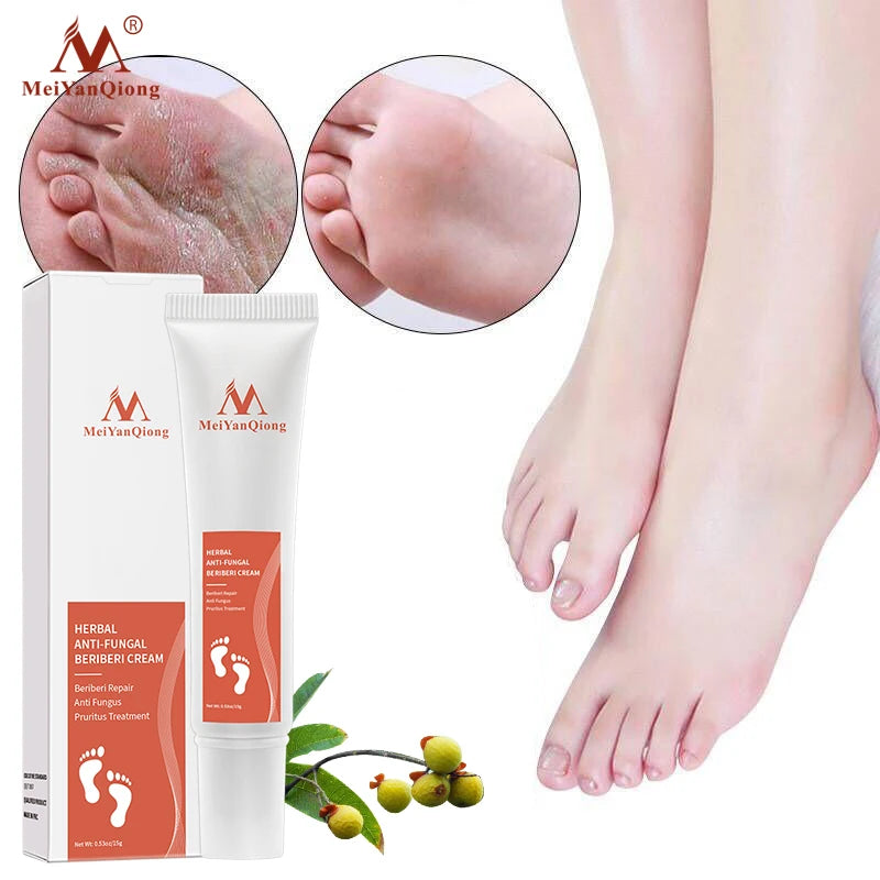 Foot Care Cream Foot spa Pedicure Herbal Detox Anti Fungal Infection Onychomycosis Fungus Treatment For legs